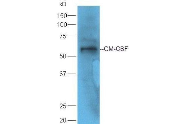 GM-CSF antibody  (AA 65-144)