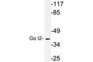 Western blot (WB) analysis of Gα t2 antibody in extracts from COLO cells. (GNAT2 antibody)