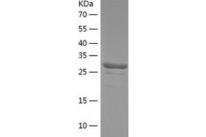 Western Blotting (WB) image for Phenazine Biosynthesis-Like Protein Domain Containing 1 (PBLD1) (AA 1-288) protein (His tag) (ABIN7124389)