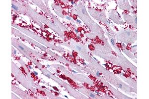Immunohistochemistry (IHC) image for anti-Potassium Voltage-Gated Channel, Shaker-Related Subfamily, Member 10 (KCNA10) (N-Term) antibody (ABIN2776179) (KCNA10 antibody  (N-Term))