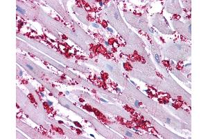 Immunohistochemistry (IHC) image for anti-Potassium Voltage-Gated Channel, Shaker-Related Subfamily, Member 10 (KCNA10) (N-Term) antibody (ABIN501379) (KCNA10 antibody  (N-Term))