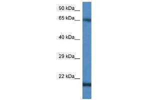 Western Blot showing CTAG1B antibody used at a concentration of 1 ug/ml against Jurkat Cell Lysate