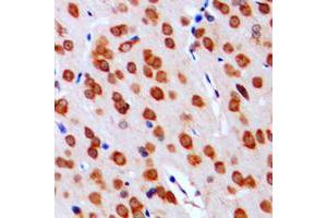 Immunohistochemical analysis of DGK alpha staining in human brain formalin fixed paraffin embedded tissue section. (DGKA antibody  (Center))