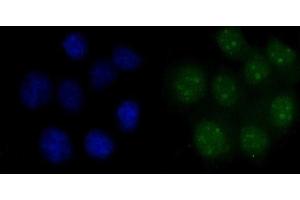 IF analysis of FEN1 using anti-FEN1 antibody (ABIN7601619).