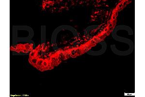 Formalin-fixed and paraffin embedded rat eye, ciliary body labeled Anti-PEGF Polyclonal Antibody, Unconjugated (ABIN672456) at 1:200, followed by conjugation to the secondary antibody Goat Anti-Rabbit IgG, Cy3 conjugated used at 1:200 dilution for 40 minutes at 37°C.