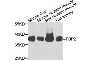 Western blot analysis of extracts of various cells, using FBP2 antibody.