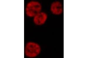 ABIN6268985 staining HeLa cells by IF/ICC.