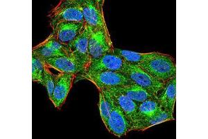 Immunocytochemistry (ICC) image for anti-Protein-tyrosine Phosphatase 1C (PTPN6) (AA 243-541) antibody (ABIN5874772) (SHP1 antibody  (AA 243-541))