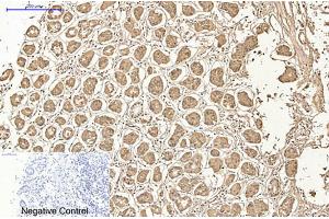 Immunohistochemical analysis of paraffin-embedded human stomach tissue. (AMACR antibody)