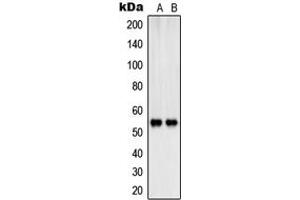 Western blot analysis of SHB (pY246) expression in K562 (A), HepG2 (B) whole cell lysates. (SHB antibody  (pTyr246))