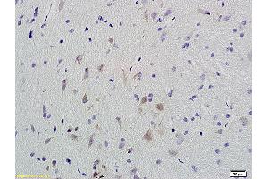 Formalin-fixed and paraffin embedded rat brain labeled with Anti-Phospho-CaMKII (Thr286) Polyclonal Antibody, Unconjugated (ABIN732473) at 1:200 followed by conjugation to the secondary antibody and DAB staining. (CAMK2B antibody  (pThr287))