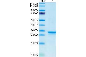 Mouse PS20 on Tris-Bis PAGE under reduced condition. (WFDC1 Protein (AA 24-211) (His tag))