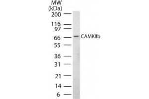 Image no. 1 for anti-Calcium/calmodulin-Dependent Protein Kinase II beta (CAMK2B) (AA 499-513) antibody (ABIN221188) (CAMK2B antibody  (AA 499-513))
