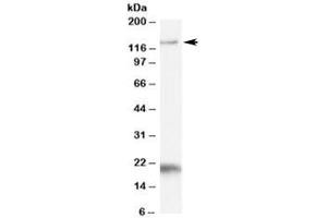 Western blot testing of Daudi cell lysate with HTATSF1 antibody at 1ug/ml. (HTATSF1 antibody)