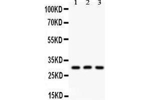 Anti- HOXA9 antibody, Western blotting All lanes: Anti HOXA9  at 0. (HOXA9 antibody  (AA 1-204))