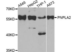 Western blot analysis of extracts of various cell lines, using PNPLA2 antibody (ABIN5973676) at 1/1000 dilution. (PNPLA2 antibody)