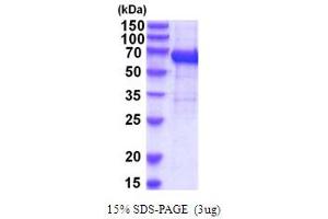 SDS-PAGE (SDS) image for Interleukin 12 Receptor beta 1 (IL12RB1) (AA 24-545) protein (His tag) (ABIN5854228)