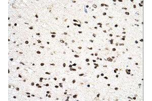 Image no. 1 for anti-Phosphatidylglycerophosphate Synthase 1 (PGS1) (C-Term) antibody (ABIN6738518) (PGS1 antibody  (C-Term))