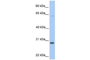 HPRT1 antibody used at 1 ug/ml to detect target protein.