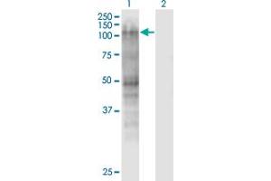 Western Blot analysis of MSH2 expression in transfected 293T cell line by MSH2 monoclonal antibody (M01), clone 2G9. (MSH2 antibody  (AA 835-934))