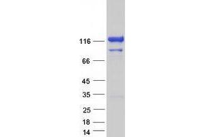 Vcpip1 Protein (Myc-DYKDDDDK Tag)