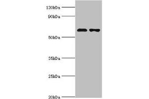 Western blot All lanes: Sterol O-acyltransferase 1 antibody at 2 μg/mL Lane 1: 293T whole cell lysate Lane 2: Jurkat whole cell lysate Secondary Goat polyclonal to rabbit IgG at 1/10000 dilution Predicted band size: 65, 59, 58 kDa Observed band size: 65 kDa (SOAT1 antibody  (AA 1-130))
