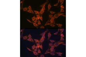 Immunofluorescence analysis of NIH-3T3 cells using ULK3 Rabbit mAb (ABIN7271222) at dilution of 1:100 (40x lens). (ULK3 antibody)