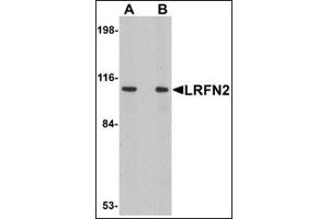 Western blot analysis of LRFN2 in rat brain lysate with this product at (A) 1 and (B) 2 μg/ml.