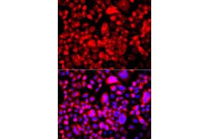 Immunofluorescence (IF) image for anti-Fatty Acid Synthase (FASN) (AA 2212-2511) antibody (ABIN3020991)