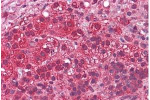 Human Adrenal: Formalin-Fixed, Paraffin-Embedded (FFPE) (LYPD3 antibody  (N-Term))