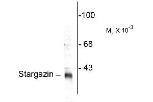 Western blots of rat synaptic membrane (SPM) showing specific immunolabeling of the ~ 36k stargazin protein. (Stargazin antibody  (C-Term))