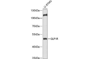 Western blot analysis of extracts of U-87MG cells, using GLP1R antibody (ABIN6131005, ABIN6141137, ABIN6141139 and ABIN6218185) at 1:1000 dilution. (GLP1R antibody  (AA 22-116))