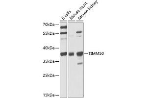 Western blot analysis of extracts of various cell lines, using TIMM50 antibody (ABIN6132725, ABIN6149170, ABIN6149171 and ABIN6225341) at 1:1000 dilution. (TIMM50 antibody  (AA 190-456))
