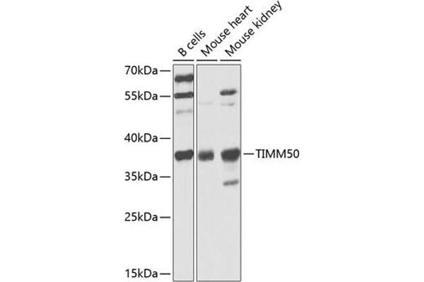 TIMM50 抗体  (AA 190-456)