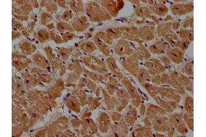 IHC image of ABIN7150096 diluted at 1:100 and staining in paraffin-embedded human heart tissue performed on a Leica BondTM system. (DIXDC1 antibody  (AA 70-333))