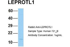 Host: Rabbit Target Name: LEPROTL1 Sample Type: Human 721_B Antibody Dilution: 1.