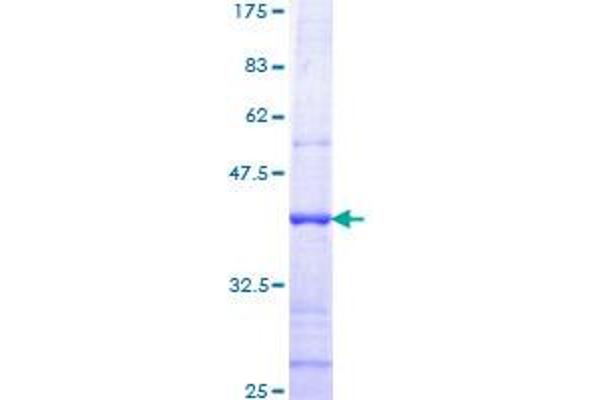 TMPRSS2 Protein (AA 383-492) (GST tag)