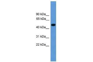 Western Blot showing PSEN1 antibody used at a concentration of 1-2 ug/ml to detect its target protein.