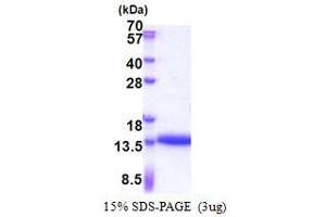 SDS-PAGE (SDS) image for Cysteine-Rich Protein 1 (Intestinal) (CRIP1) (AA 1-77) protein (His tag) (ABIN5853298)