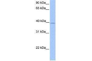 WB Suggested Anti-ZFP92 Antibody Titration:  0.