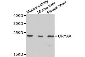 Western blot analysis of extracts of mouse tissues, using CRYAA antibody. (CRYAA antibody)