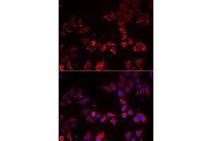 Immunofluorescence analysis of A549 cell using LIMS1 antibody.