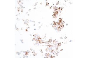 Immunocytochemistry (ICC) image for anti-Platelet Derived Growth Factor Receptor beta (PDGFRB) (AA 33-532) antibody (ABIN7453377)
