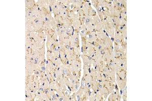 Immunohistochemistry of paraffin-embedded mouse heart using SFRP2 antibody (ABIN5973117) at dilution of 1/200 (40x lens).