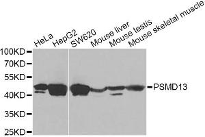 Western blot analysis of extracts of various cell lines, using PSMD13 Antibody. (PSMD13 antibody)