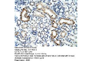 Rabbit Anti-ZESR2 Antibody  Paraffin Embedded Tissue: Human Kidney Cellular Data: Epithelial cells of renal tubule Antibody Concentration: 4. (ZRSR2 antibody  (C-Term))