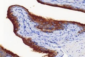 Immunohistochemistry analysis of paraffin-embedded mouse bladder using,Uroplakin Ia (ABIN7076160) at dilution of 1: 4000 (UPK1A antibody)