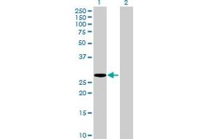 Western Blot analysis of HLA-DMA expression in transfected 293T cell line by HLA-DMA MaxPab polyclonal antibody.