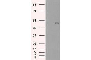 Western Blotting (WB) image for anti-Cytochrome P450, Family 2, Subfamily E, Polypeptide 1 (CYP2E1) antibody (ABIN2718987)