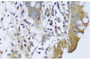Immunohistochemistry of paraffin-embedded Human colon using GCN1L1 Polyclonal Antibody at dilution of 1:150 (40x lens). (GCN1L1 antibody)